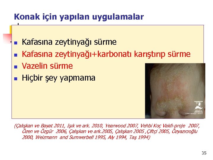 Konak için yapılan uygulamalar n n Kafasına zeytinyağı sürme Kafasına zeytinyağı+karbonatı karıştırıp sürme Vazelin
