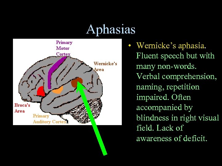 Aphasias • Wernicke’s aphasia. Fluent speech but with many non-words. Verbal comprehension, naming, repetition