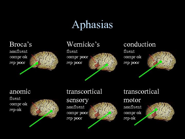 Aphasias Broca’s Wernicke’s conduction nonfluent compr ok rep poor fluent compr poor rep poor