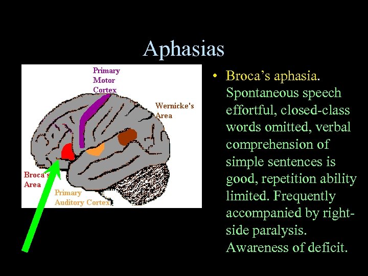 Aphasias • Broca’s aphasia. Spontaneous speech effortful, closed-class words omitted, verbal comprehension of simple