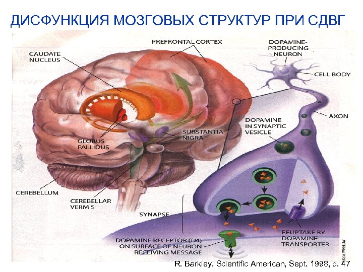 ДИСФУНКЦИЯ МОЗГОВЫХ СТРУКТУР ПРИ СДВГ R. Barkley, Scientific American, Sept. 1998, p. 47 