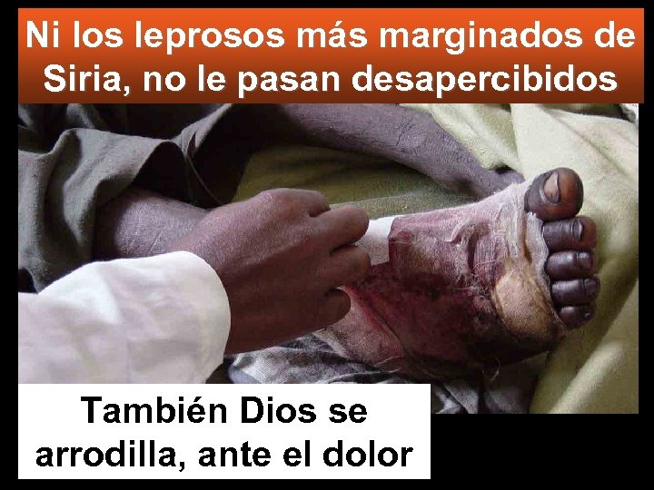 Ni los leprosos más marginados de Siria, no le pasan desapercibidos También Dios se