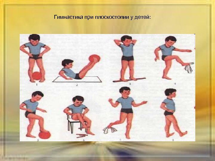 Гимнастика при плоскостопии у детей: 