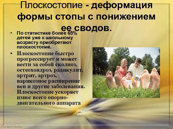  • Плоскостопие - деформация формы стопы с понижением ее сводов. По статистике более