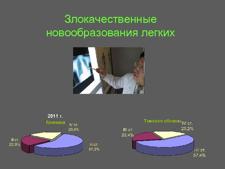 Злокачественные новообразования легких 