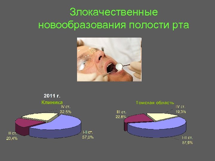 Злокачественные новообразования полости рта 