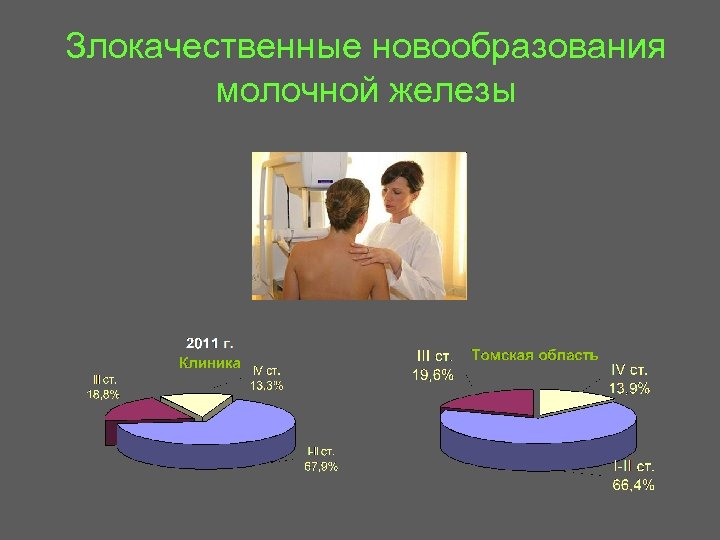 Злокачественные новообразования молочной железы 