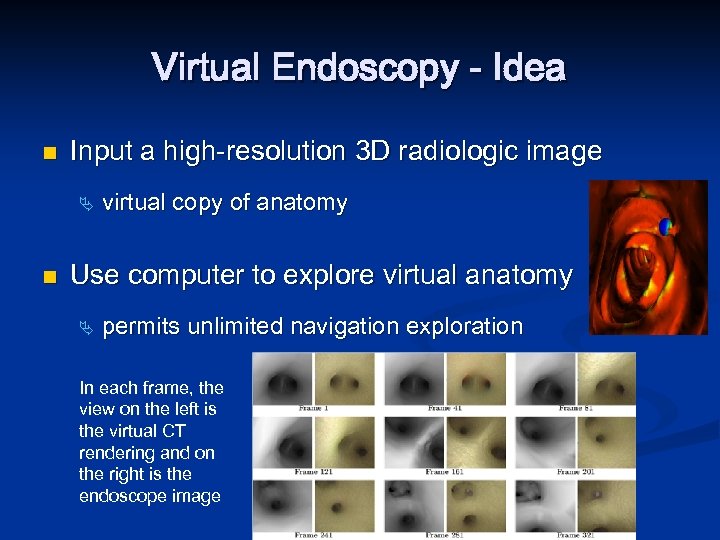 Virtual Endoscopy - Idea n Input a high-resolution 3 D radiologic image Ä n
