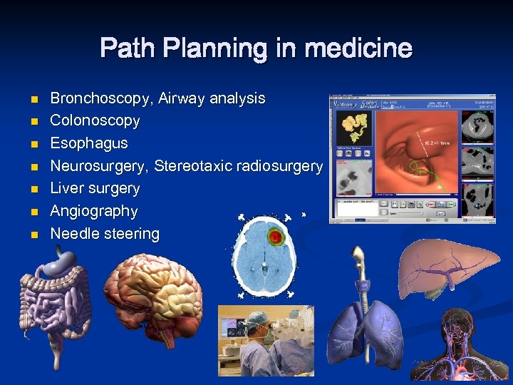 Path Planning in medicine n n n n Bronchoscopy, Airway analysis Colonoscopy Esophagus Neurosurgery,