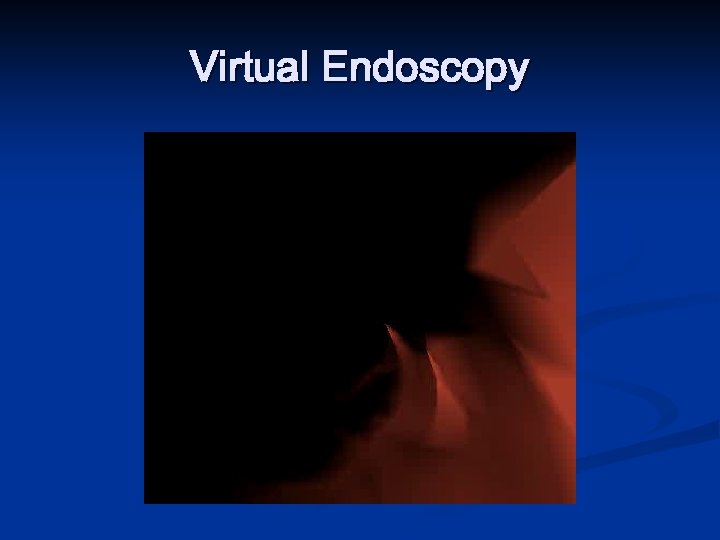 Virtual Endoscopy 