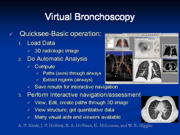 Virtual Bronchoscopy ü Quicksee-Basic operation: 1. Load Data ü 2. 3 D radiologic image