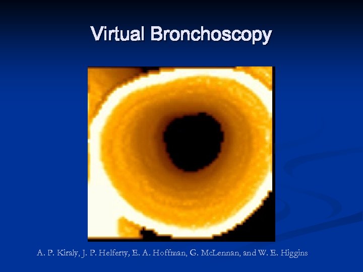 Virtual Bronchoscopy A. P. Kiraly, J. P. Helferty, E. A. Hoffman, G. Mc. Lennan,
