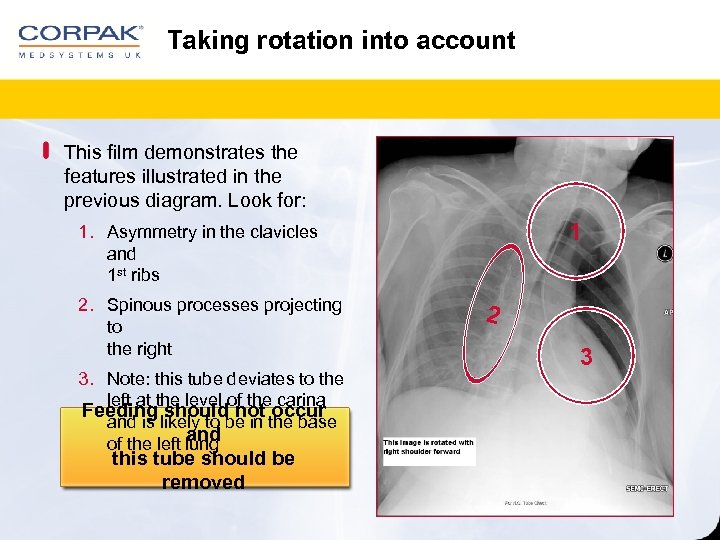 Taking rotation into account This film demonstrates the features illustrated in the previous diagram.