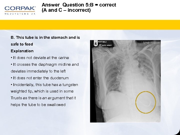 Answer Question 5: B = correct (A and C – incorrect) B. This tube