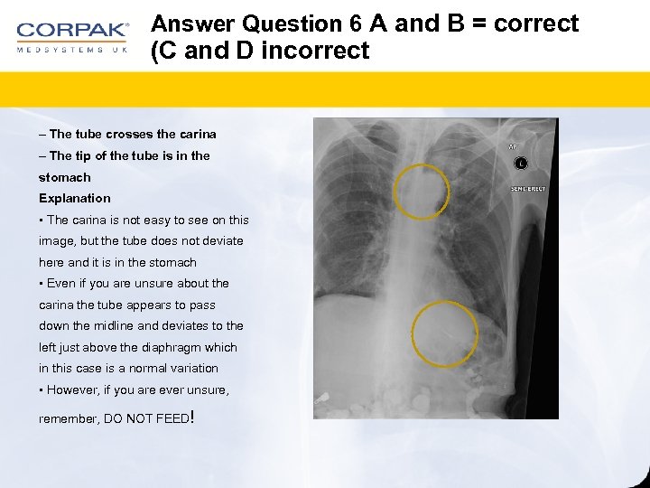 Answer Question 6 A and B = correct (C and D incorrect – The
