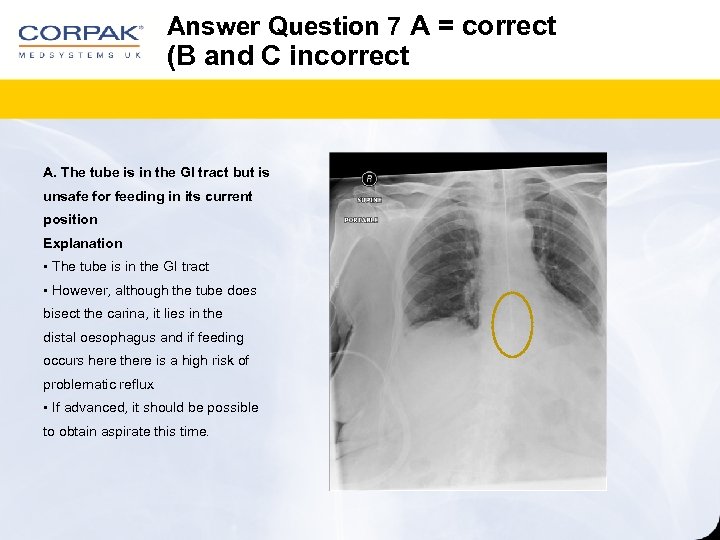 Answer Question 7 A = correct (B and C incorrect A. The tube is