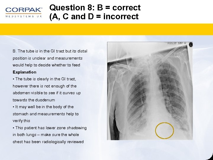 Question 8: B = correct (A, C and D = incorrect B. The tube