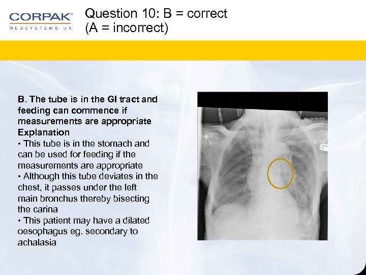 Question 10: B = correct (A = incorrect) B. The tube is in the