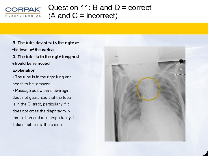 Question 11: B and D = correct (A and C = incorrect) B. The
