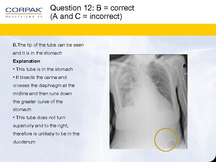 Question 12: B = correct (A and C = incorrect) B. The tip of