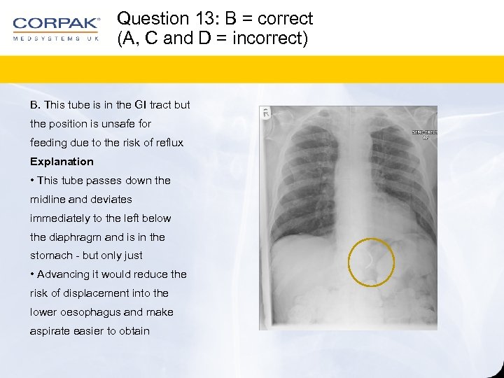 Question 13: B = correct (A, C and D = incorrect) B. This tube