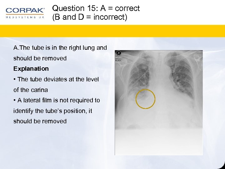 Question 15: A = correct (B and D = incorrect) A. The tube is