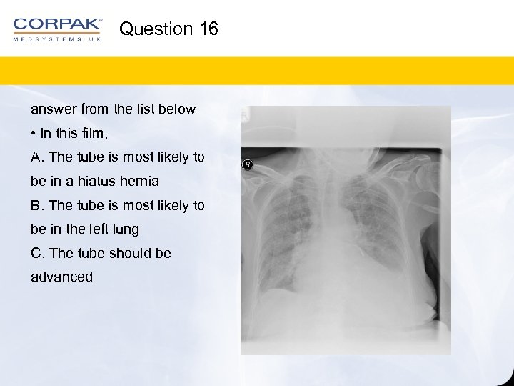 Question 16 answer from the list below • In this film, A. The tube