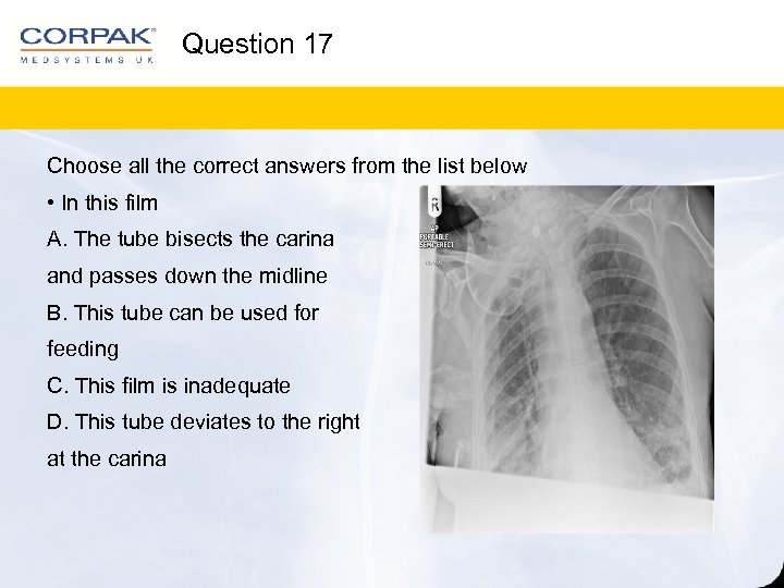 Question 17 Choose all the correct answers from the list below • In this