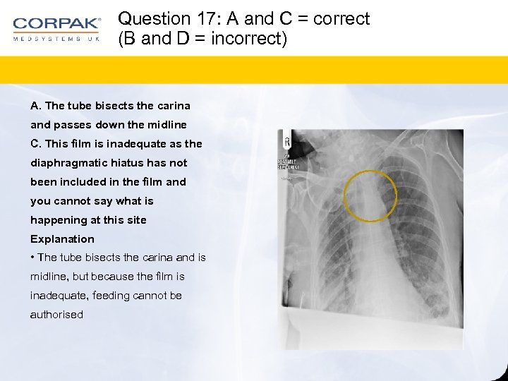 Question 17: A and C = correct (B and D = incorrect) A. The