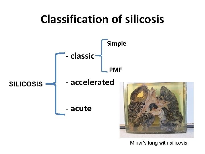 Classification of silicosis Simple - classic PMF SILICOSIS - accelerated - acute Miner's lung