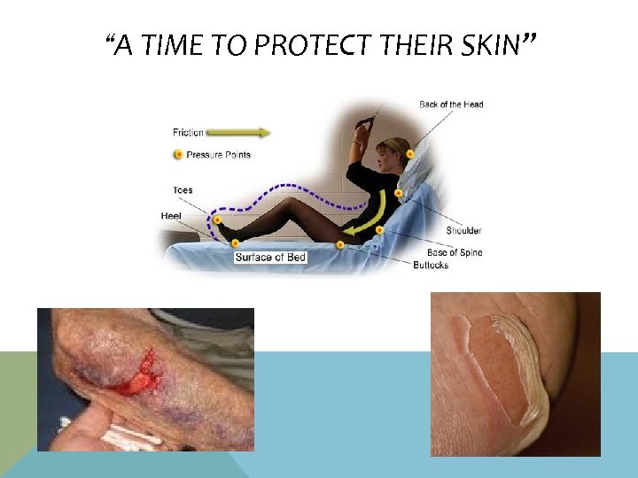 “A TIME TO PROTECT THEIR SKIN” 