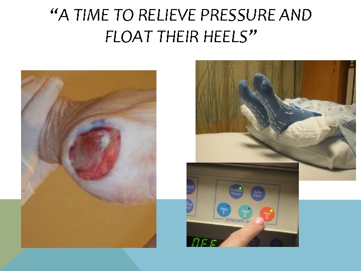 “A TIME TO RELIEVE PRESSURE AND FLOAT THEIR HEELS” 