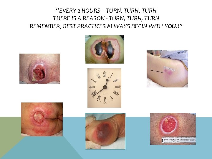 “EVERY 2 HOURS - TURN, TURN THERE IS A REASON - TURN, TURN REMEMBER,