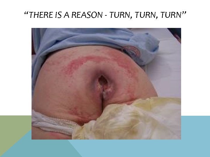 “THERE IS A REASON - TURN, TURN” 