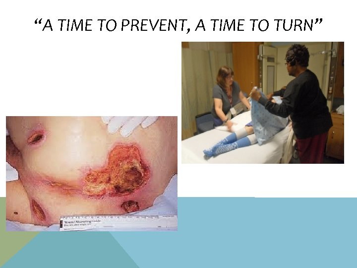 “A TIME TO PREVENT, A TIME TO TURN” 