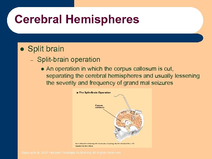 Cerebral Hemispheres l Split brain – Split-brain operation l An operation in which the