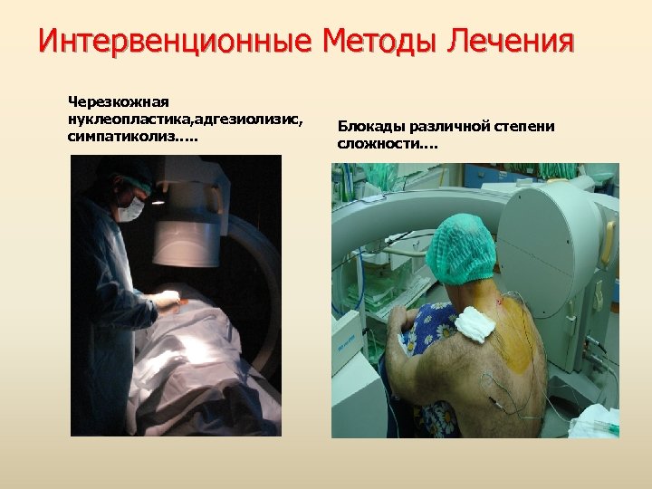 Интервенционные Методы Лечения Черезкожная нуклеопластика, адгезиолизис, симпатиколиз…. . Блокады различной степени сложности…. 