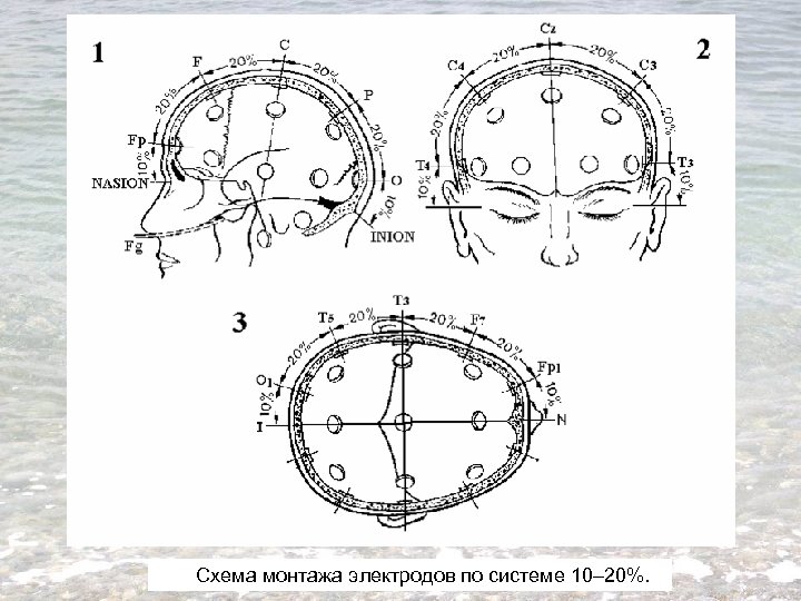 Схема монтажа электродов по системе 10– 20%. 