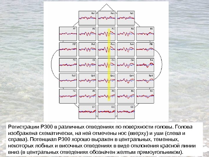 Регистрации Р 300 в различных отведениях по поверхности головы. Голова изображена схематически, на ней