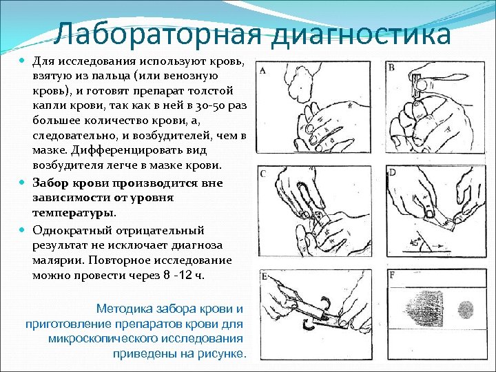 Лабораторная диагностика Для исследования используют кровь, взятую из пальца (или венозную кровь), и готовят