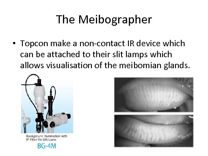 The Meibographer • Topcon make a non-contact IR device which can be attached to