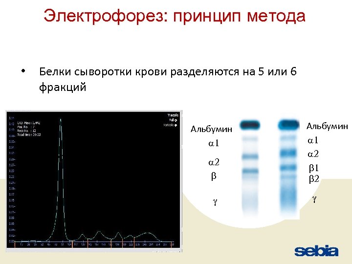 Электрофорез: принцип метода • Белки сыворотки крови разделяются на 5 или 6 фракций Альбумин