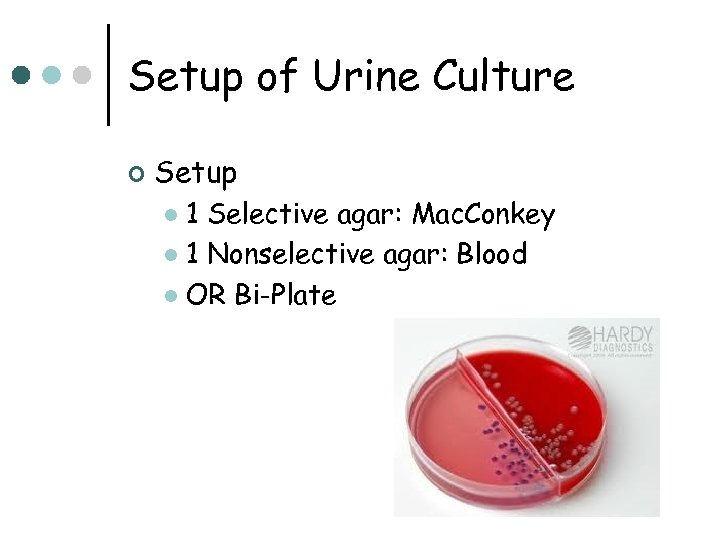 Setup of Urine Culture ¢ Setup 1 Selective agar: Mac. Conkey l 1 Nonselective