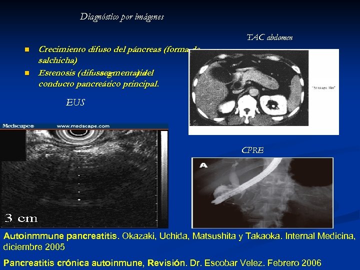 Diagnóstico por imágenes TAC abdomen n n Crecimiento difuso del páncreas (forma de salchicha)