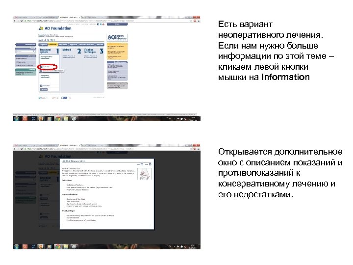 Есть вариант неоперативного лечения. Если нам нужно больше информации по этой теме – кликаем