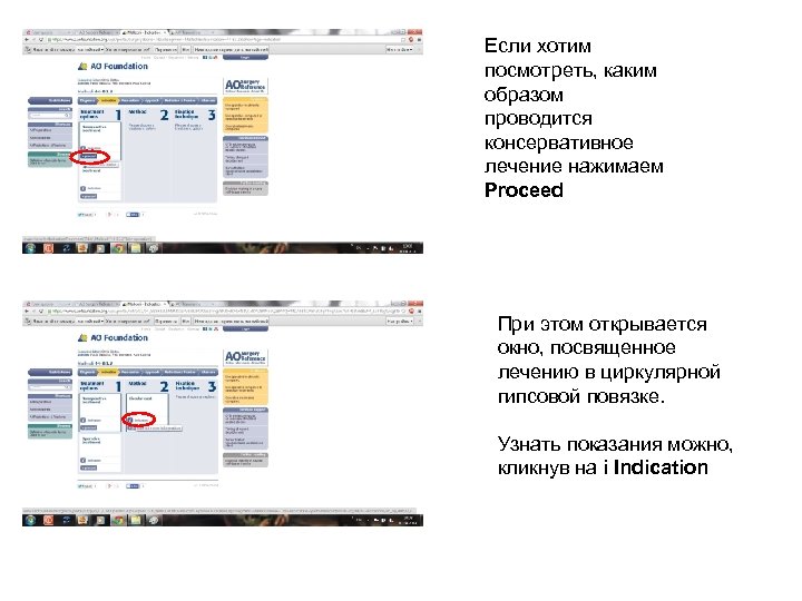 Если хотим посмотреть, каким образом проводится консервативное лечение нажимаем Proceed При этом открывается окно,
