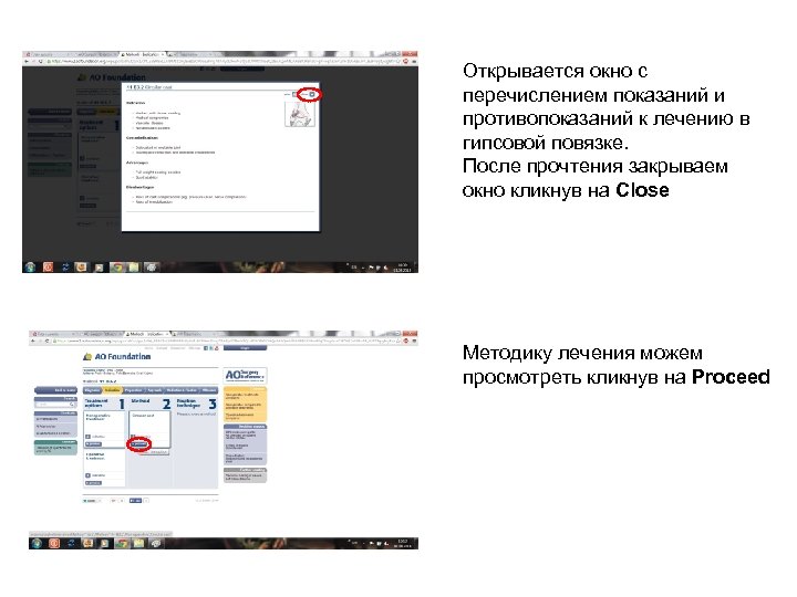 Открывается окно с перечислением показаний и противопоказаний к лечению в гипсовой повязке. После прочтения