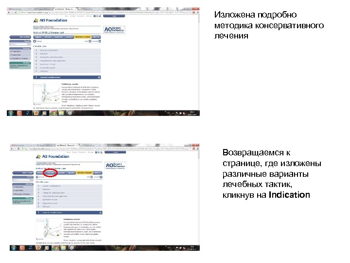 Изложена подробно методика консервативного лечения Возвращаемся к странице, где изложены различные варианты лечебных тактик,