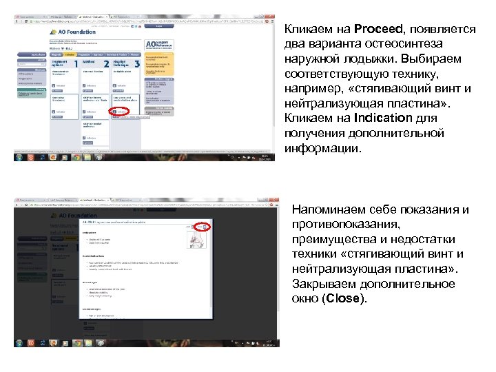 Кликаем на Proceed, появляется два варианта остеосинтеза наружной лодыжки. Выбираем соответствующую технику, например, «стягивающий