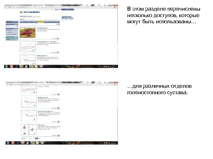 В этом разделе перечислены несколько доступов, которые могут быть использованы… …для различных отделов голеностопного